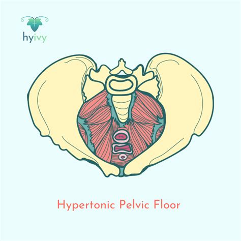 Your Trusted Resource for Common Pelvic Health Terms | Hyivy