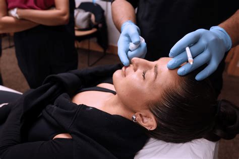 How Long Does Botox Last?