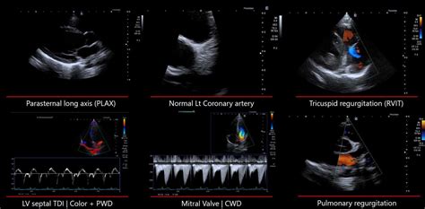 Canon Aplio flex купити в Україні | InMed