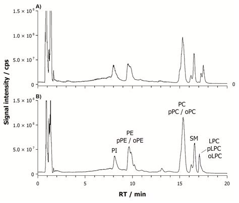 Searching for Potential Lipid Biomarkers of Parkinson’s Disease in ...