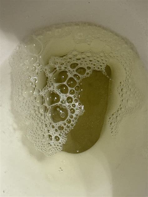 LARGE Bubbles!? Vs 20 min later : r/foamyurine