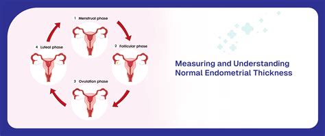 Endometrial Thickness FET #1 | Endometrial Thickness Scan Oh So