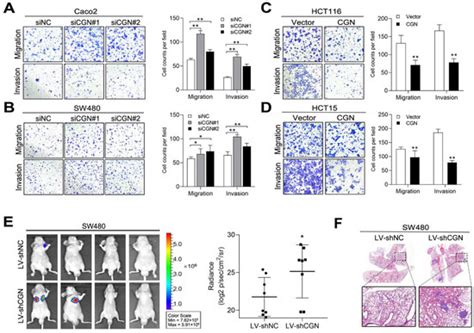 miR-125b Promotes Colorectal Cancer Migration and Invasion by Dual ...