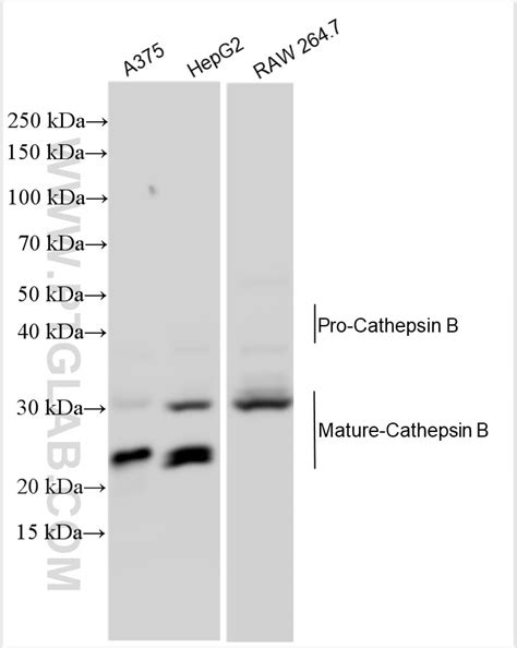 Cathepsin B antibody (31399-1-AP) | Proteintech