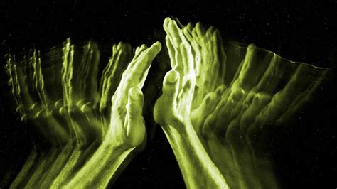 Image result for Alien Hand Syndrome Documentary