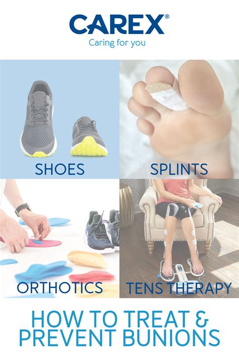 How to prevent and treat bunions – Artofit