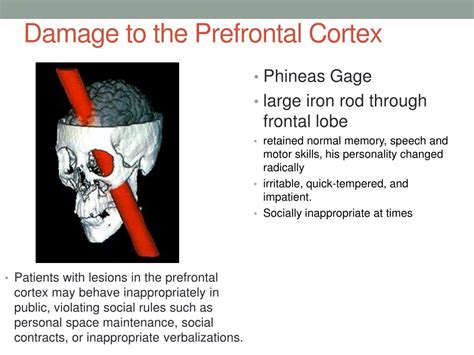 Image result for Prefrontal Cortex Damage