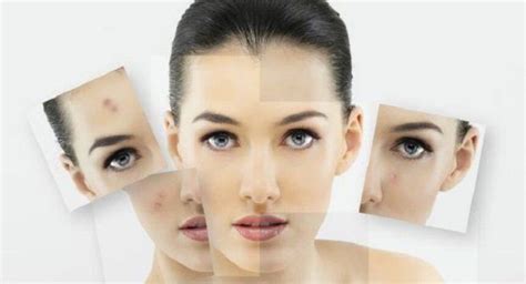 Know about these home remedies to treat dark skin pathces ...