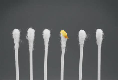 Why Do I Have White Flaky Earwax at Kathy Morelli blog
