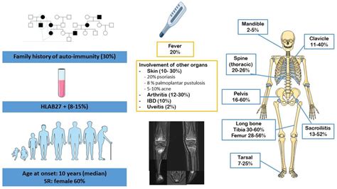 Chronic Recurrent Multifocal Osteomyelitis (CRMO) and Juvenile Spondyloarthritis (JSpA): To What ...