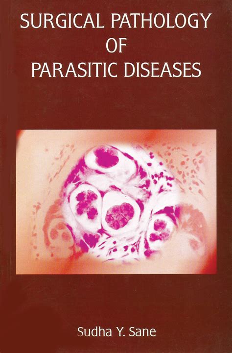 Surgical Pathology Of Parasitic Diseases