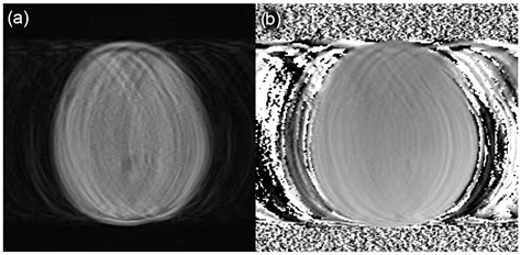 Reliability of Automated Intracranial Volume Measurements by Synthetic ...