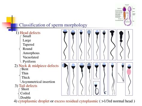 PPT - Semen analysis & Sperm processing PowerPoint Presentation - ID ...