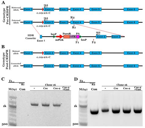 Correction of NR2E3 Associated Enhanced S-cone Syndrome Patient ...
