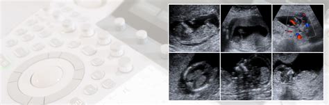 Detailed Fetal Anatomy Scan (18–22 weeks) - Petals Health