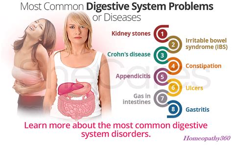 Common Digestive Disorders 的图像结果