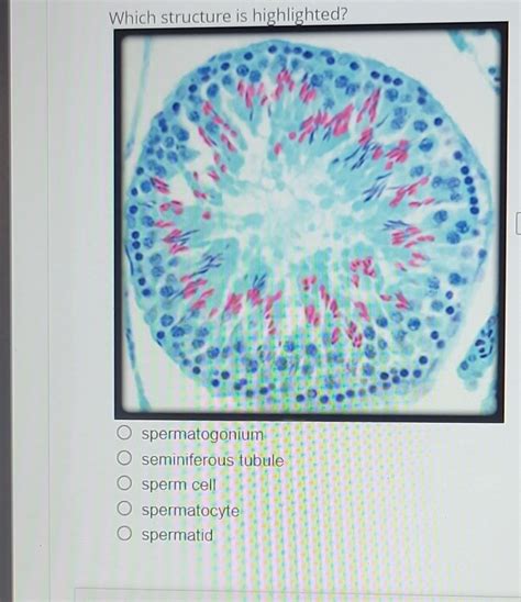 Solved Which structure is highlighted? spermatogonium | Chegg.com