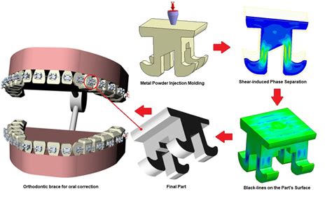 Processing Optimization for Metal Injection Molding of Orthodontic ...