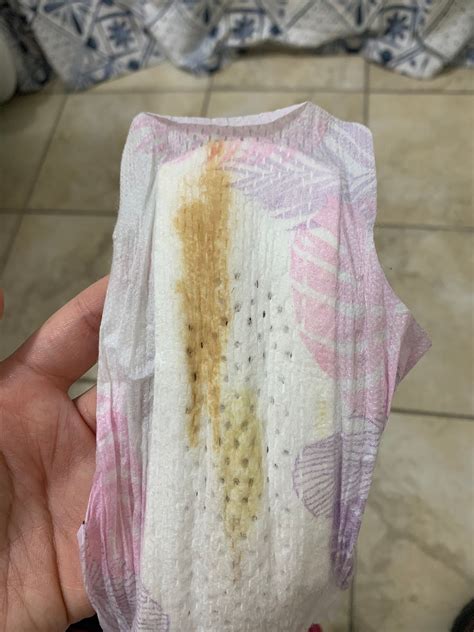 TMI- postpartum discharge | BabyCenter