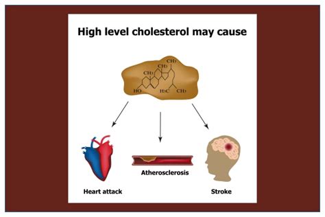 High Cholesterol: Causes, Symptoms, Diagnosis, Treatment