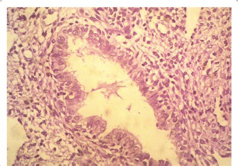 Image result for Endometrium Functional Layer