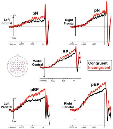 Brain Sciences | Special Issue : Neural Bases of Cognitive Processing