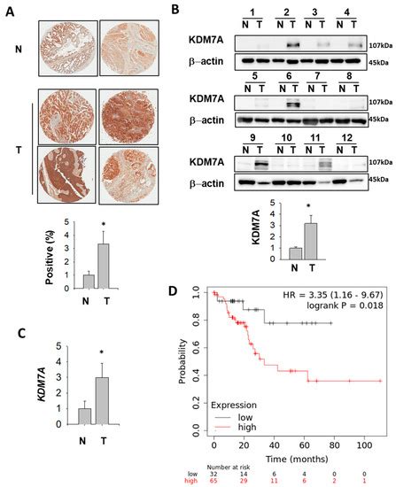 Histone Demethylase KDM7A Regulates Androgen Receptor Activity, and Its ...
