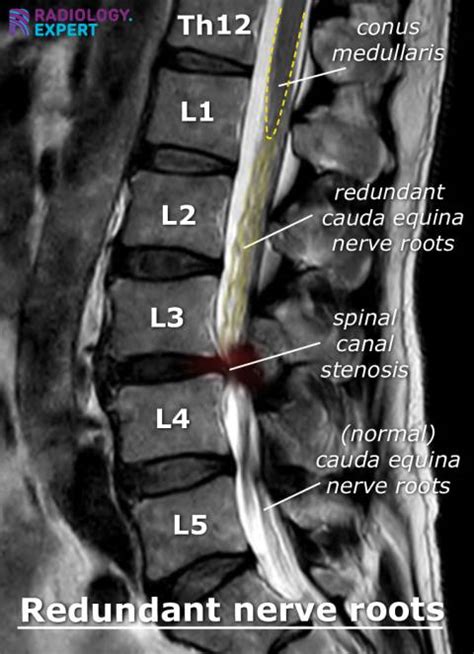 Image result for Computer Assisted Test Example