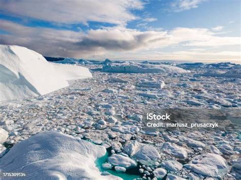 Image result for SpO2 Monitor Band