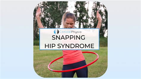 Snapping Hip Syndrome – Clinical Physio Membership