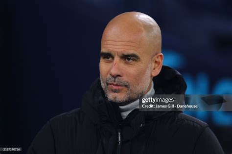 Guardiola revisits the scratches incident: 'I was caught off guard ...