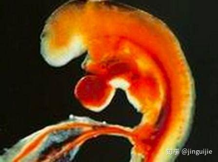 怀孕四个月意外胎停，这绝对不是意外！|染色体|胎停|怀孕|-健康界