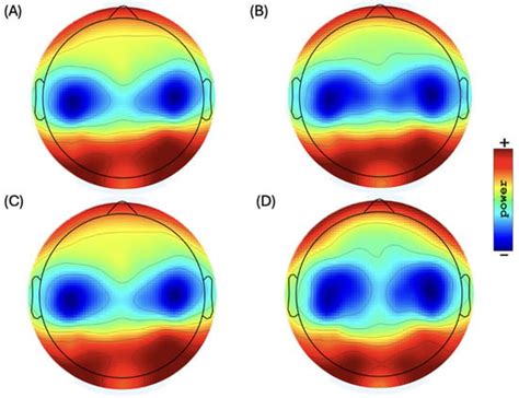 EEG Oscillations as Neuroplastic Markers of Neural Compensation in ...