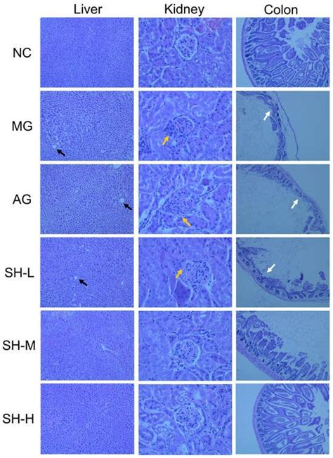 Alleviation of High-Fat Diet-Induced Hyperlipidemia in Mice by Stachys ...