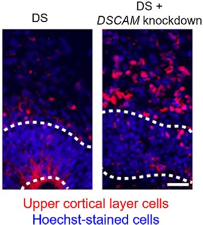 Downs Cell Diagram 的图像结果