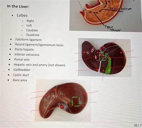 Solved In the Liver: - Lobes - Right - Left - Caudate - | Chegg.com