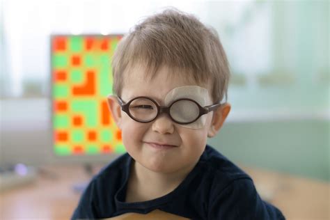 Can a Lazy Eye Be Corrected With Laser Eye Surgery