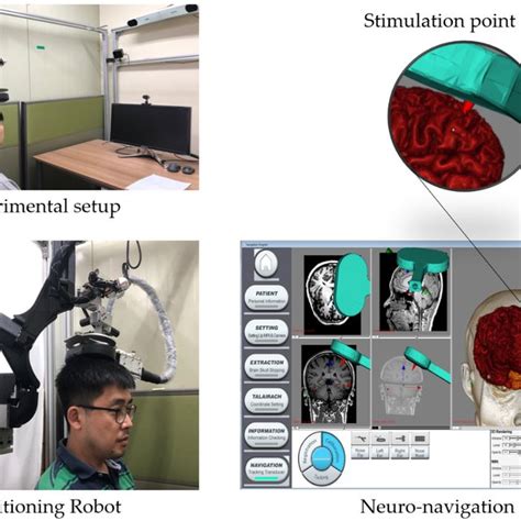 Image result for Non-Invasive Brain Stimulation