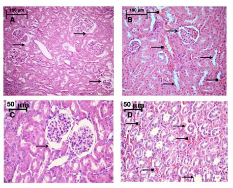 Influence of Hypoxic and Hyperoxic Preconditioning on Endothelial ...