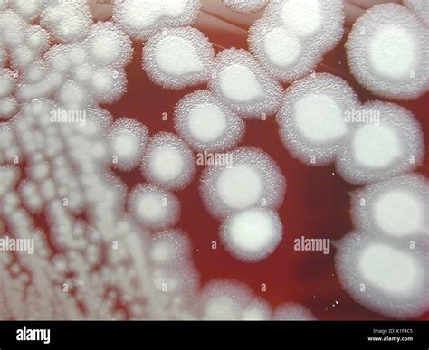 Avirulent pasteur strain hi-res stock photography and images - Alamy