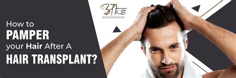Best Doctor to Consult for Hair Transplant in Delhi NCR
