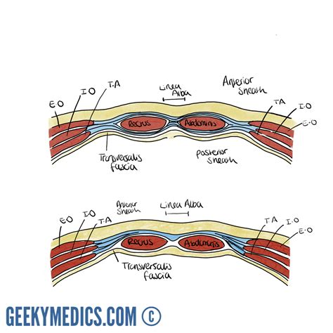Anatomy of the Abdominal Wall and Rectus Sheath | Geeky Medics
