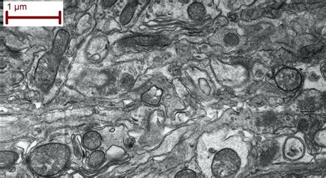 Scanning Electron Microscope Cell 的图像结果