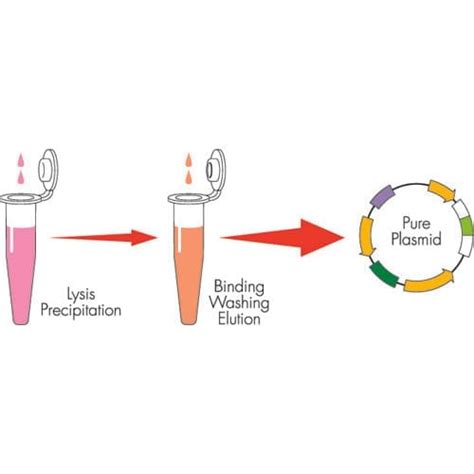 Plasmid Isolation 的图像结果