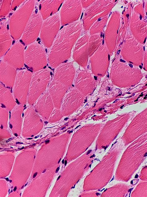 Skeletal Muscle Cross Section Slide