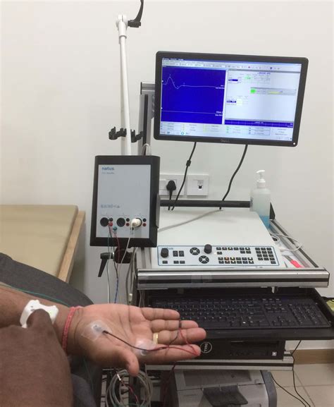 How painful is emg nerve testing - erosalsa
