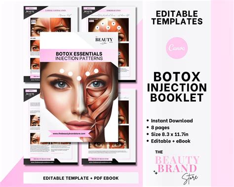 Image result for Botox Injection Patterns