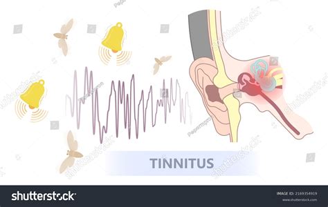 Ear Sound 的图像结果