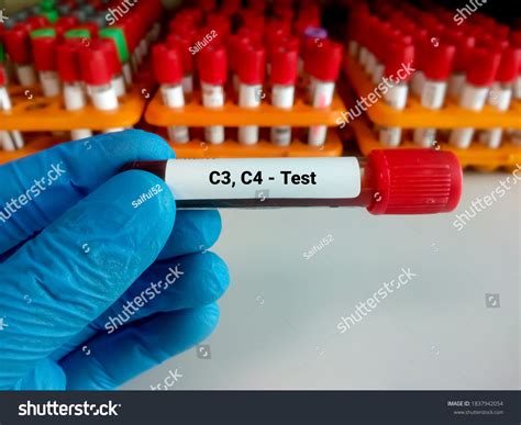 Blood Sample C3 C4 Complement Test ภาพสต็อก 1837942054 | Shutterstock
