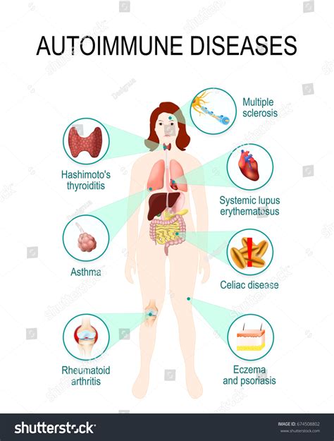 Autoimmunity 的图像结果